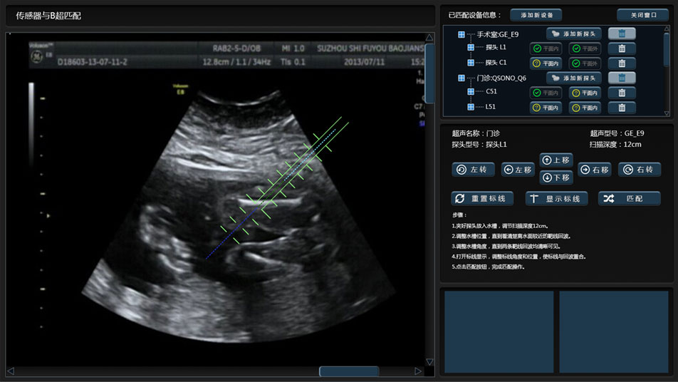 武漢睿影醫療科技超聲系統軟件界面設計
